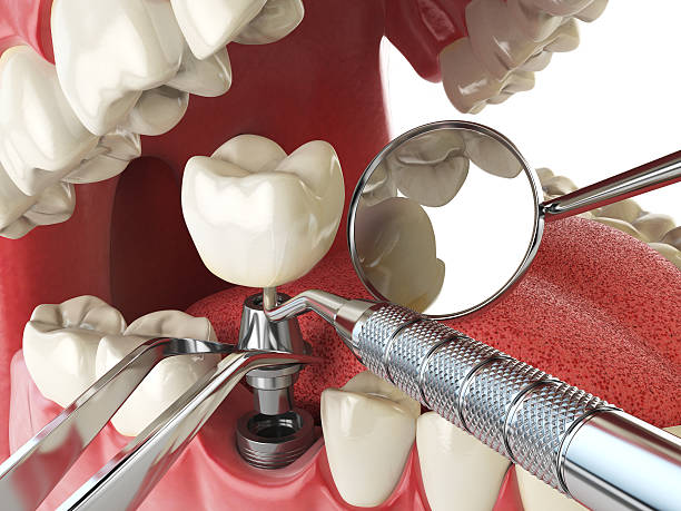  Le Roy, IL Emergency Dentist Pros